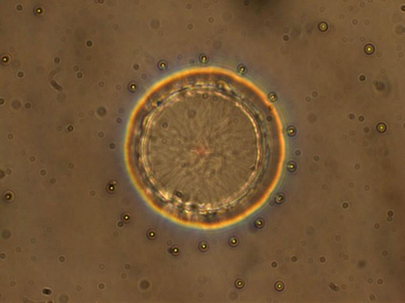 We start with a template consisting of microscopic posts that was then topped with nematic liquid crystal. In this experiment a ring-shaped defect encircled each of the posts at their midpoints. This ring then acts like another template, directing the arrangement of patterns on the liquid crystal surface, more than 50 microns away. 