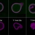 Confocal micrographs of polymersomes that membrane-disperse PZn2 (purple) and encapsulate HSAF obtained in continuous scanning mode. (A) BODIPY-FL-labeled HSAF (green, 3 mg/mL) + PZn2 vesicle, imaged using two lasers simultaneously (488 nm, 543 nm). Images proceed in time, left to right, over a period of ~5 min. (B) Unlabeled HSAF (1.5 mg/mL) + PZn2 vesicle. Vesicle imaged using three lasers simultaneously (488, 543, 633 nm). Final image of the degraded structure was not in the same plane as the original vesicle.